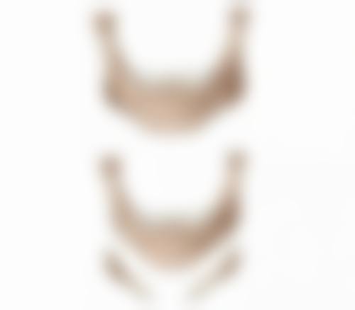 手臂抽脂手术安心吗？