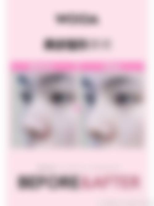 八、濮阳张大夫整形医疗美容门诊部真实的患者评价