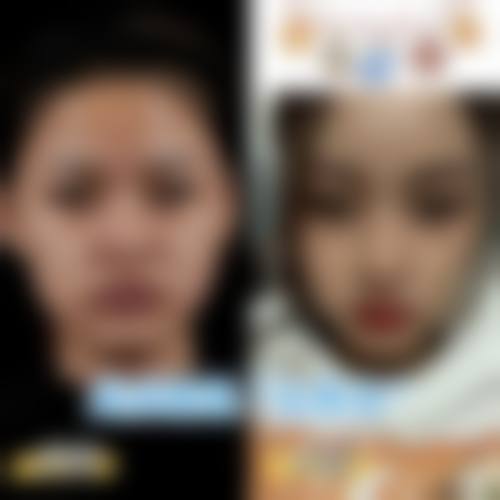 四、濮阳张大夫整形医疗美容门诊部特色项目