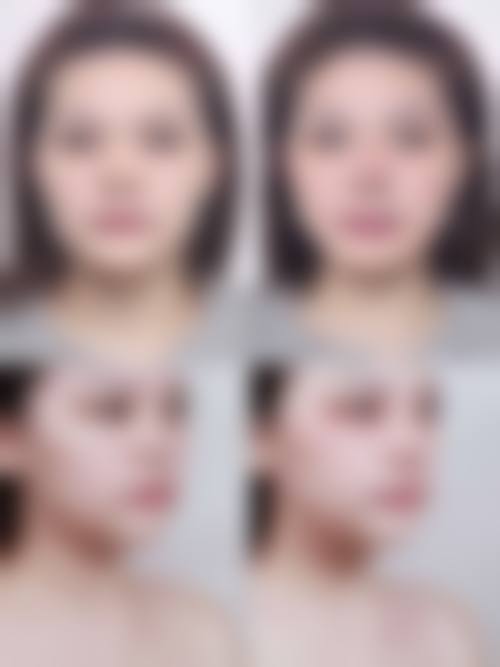 四、张亚杰收费价格表