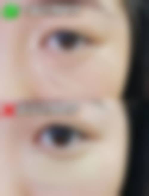 六、王保香真实的患者评价