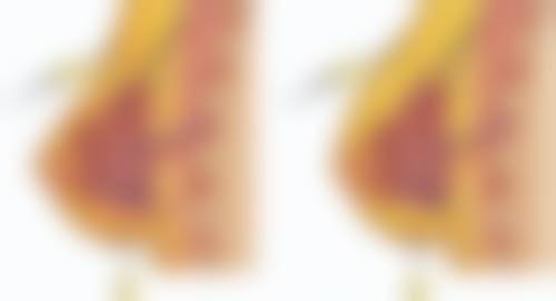 一、肚子大抽脂会反弹吗？了解抽脂原理与潜在反弹因素