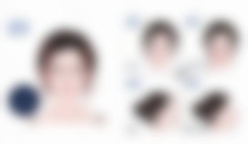 二、肚子大抽脂后为何腹部仍大？剖析常见原因