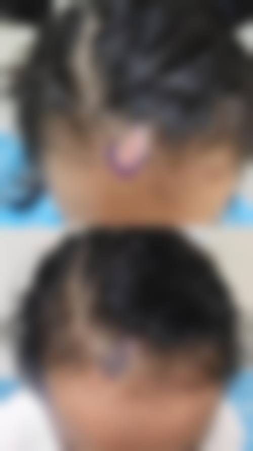 七、湖南长沙乐小妖整形医院预约方式