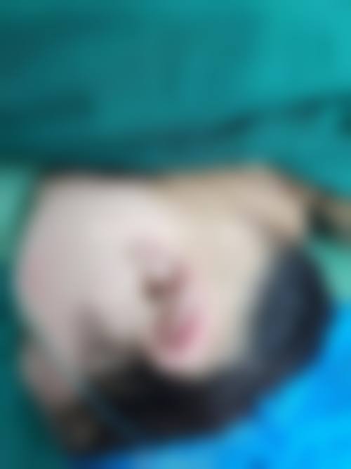 九、台州唯雅整形医院真实的患者评价