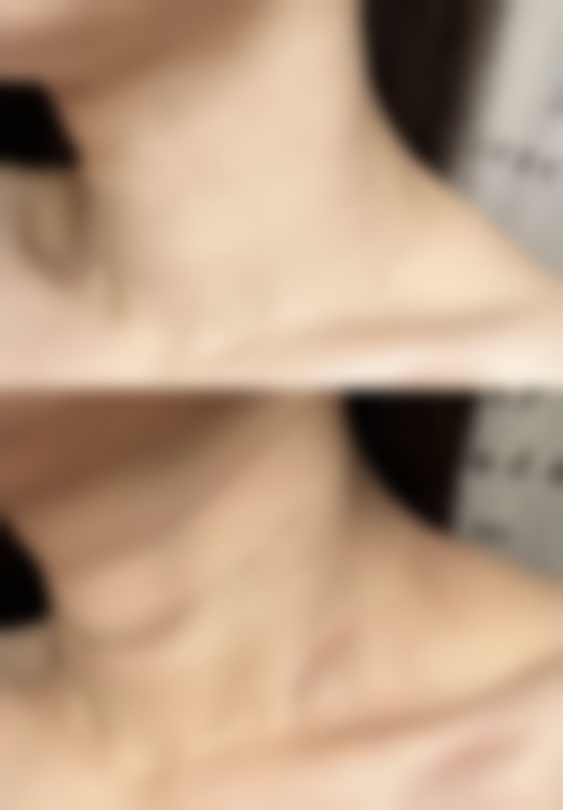 五、美观角度的注意事项