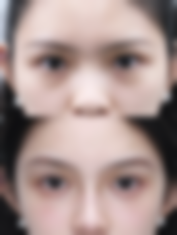 五、不同阶段的治疗注意事项