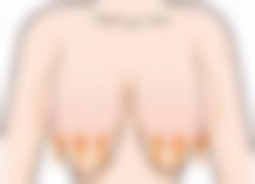 二、打瘦脸针到哪打好——经验医生是关键