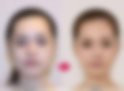 二、不同阶段的修复特点