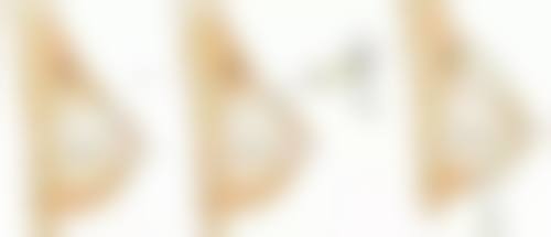 四、如何降低自体脂肪隆胸的风险