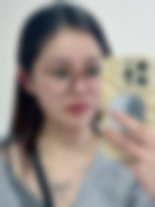 八、济南海御整形医院真实的患者评价