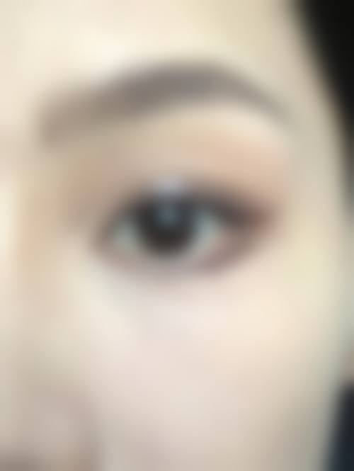 八、郑州安美星河医疗美容门诊部真实的患者评价