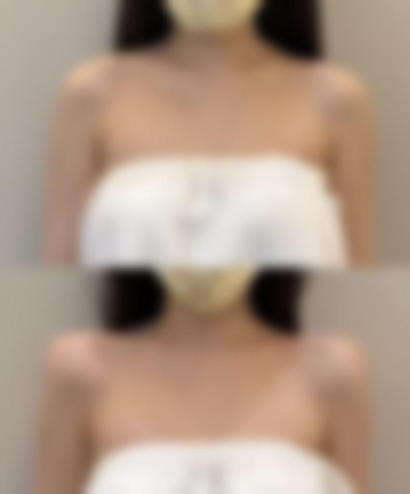 五、郑州安美星河医疗美容门诊部价格表