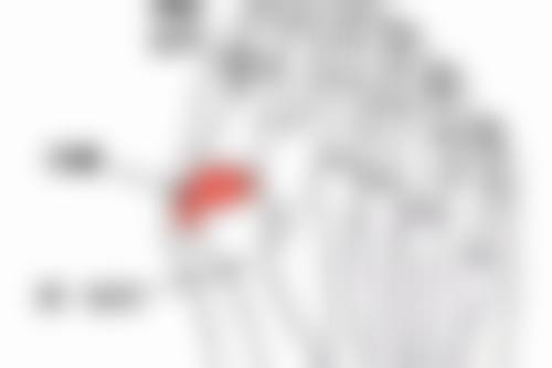 二、疤痕体质纹眉的风险