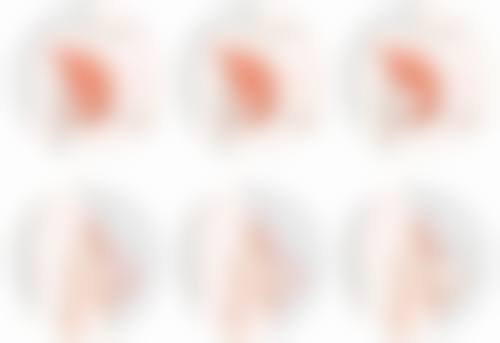 四、如何选择适合自己的隆鼻可吸收线