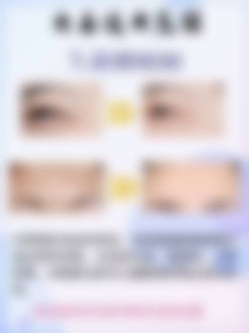 三、种植头发后的修复过程