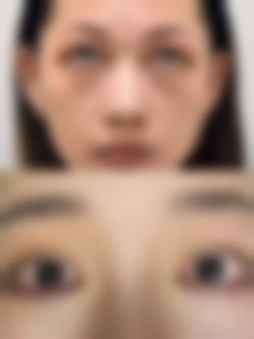 八、厦门李强美丽薇医疗美容真实的患者评价