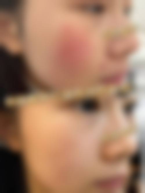 三、沈阳孙兵整形医院诊疗项目有哪些？