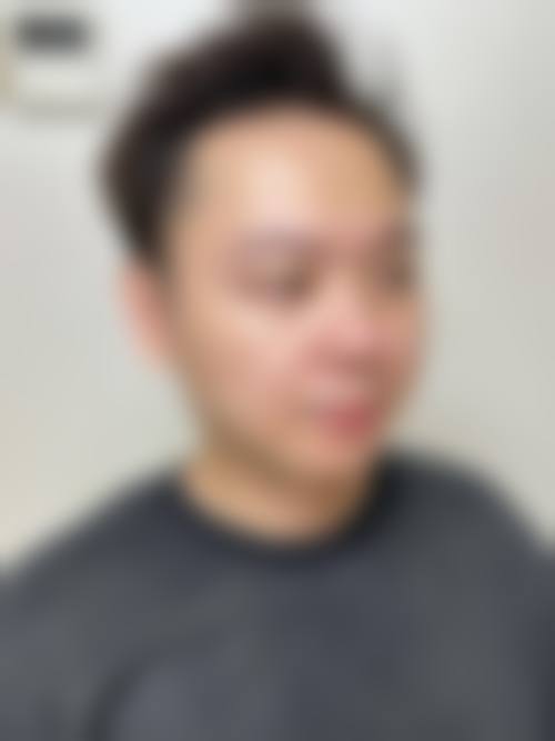 九、沈阳孙兵整形医院真实的患者评价