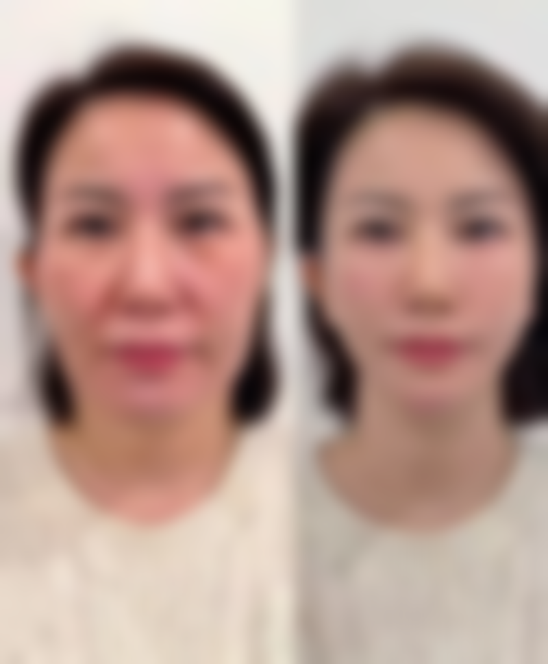 三、武汉斯启诺医疗美容门诊部主推项目及技术优势