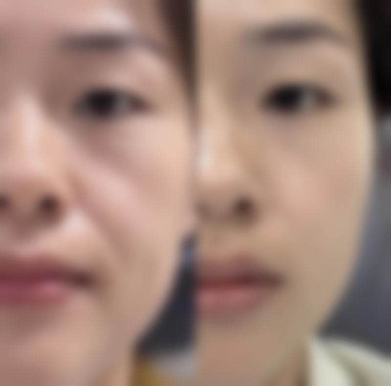 一、种植头发的适用人群