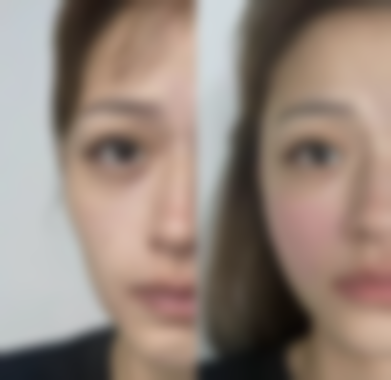 五、不同纹眉方案的适用性和风险