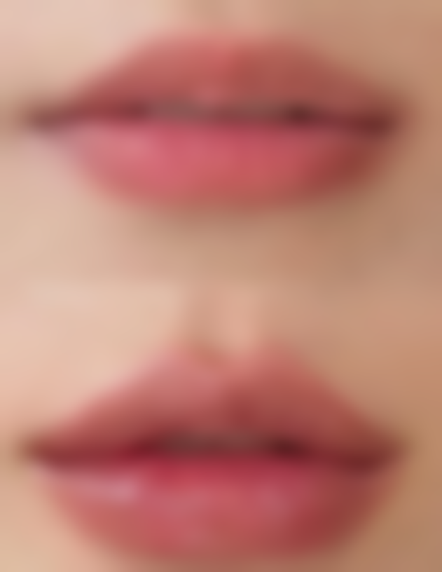 三、初次手术与修复手术的差异