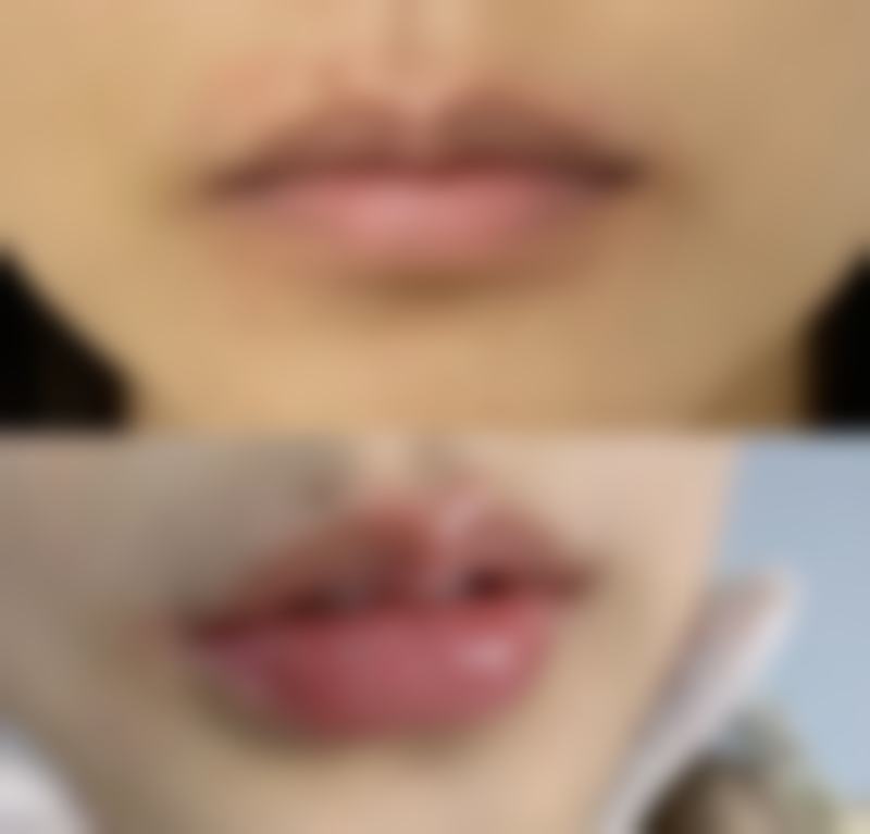 三、谨慎评估是否适合纹眉