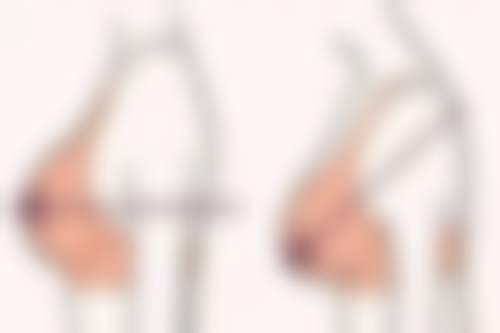 二、扬中橙子整形医院怎么样？