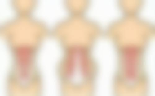 三、加速全切双眼皮修复的护理建议