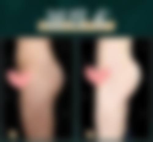 六、龚忠华真实的患者评价