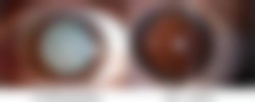 五、保持良好心态