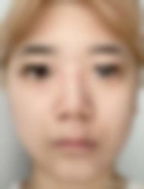 六、沈阳蓝天医疗美容价格表