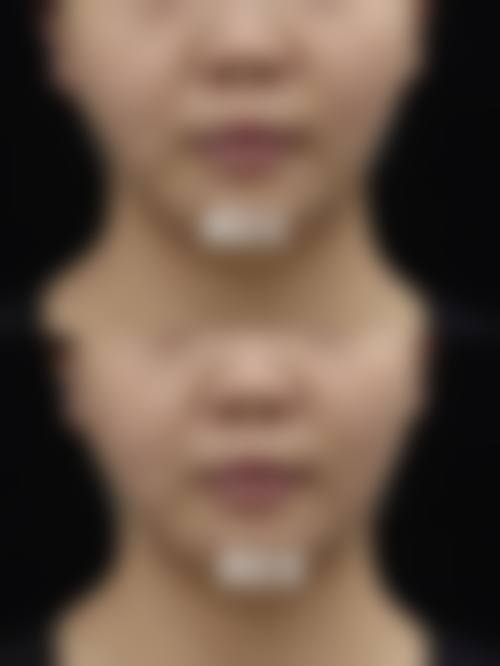 九、沈阳蓝天医疗美容真实的患者评价