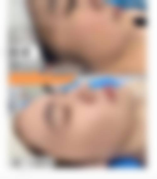 八、太仓俪人整形门诊部真实的患者评价