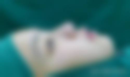 八、长沙语卿整形医院真实的患者评价