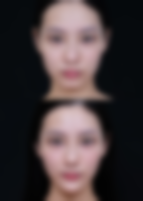 四、扬中橙子整形医院特色项目