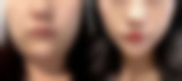 三、沈阳蓝天医疗美容诊疗项目有哪些？