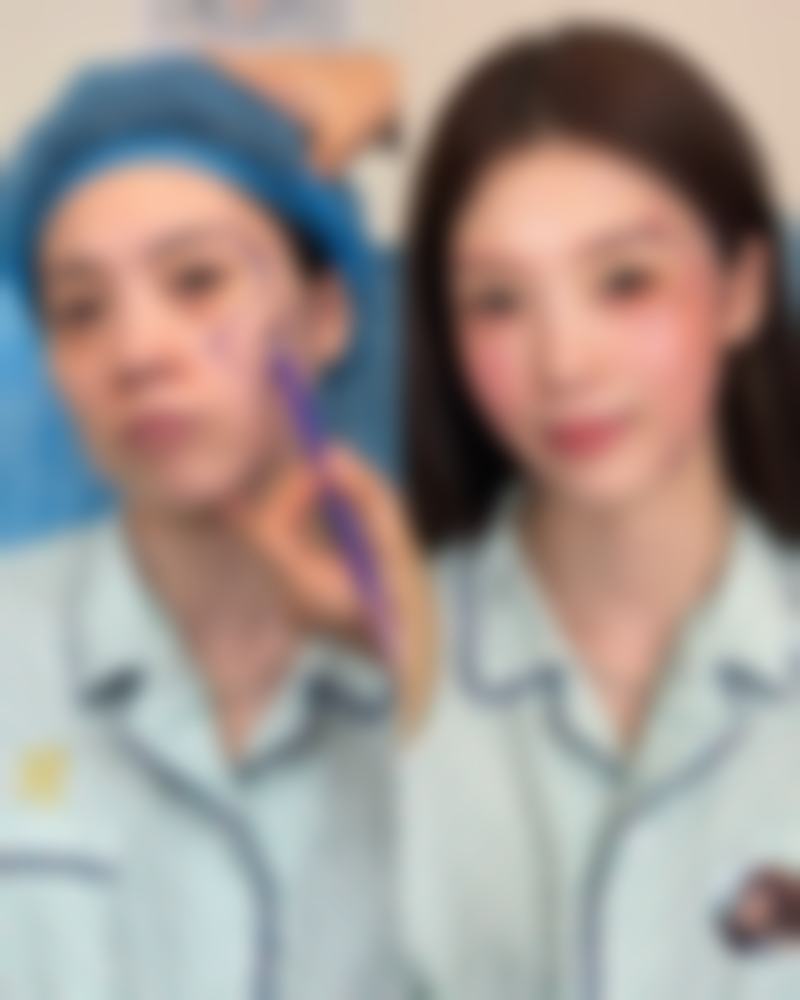 怎样可以祛掉黑眼圈眼袋？分型治疗、日常护理及医美手段全攻略来了！ 