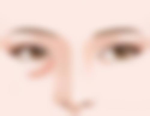 七、结尾呼应：双眼皮全切修复期是多久？