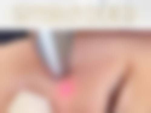 四、安徽柠檬轻医疗美容门诊部特色项目