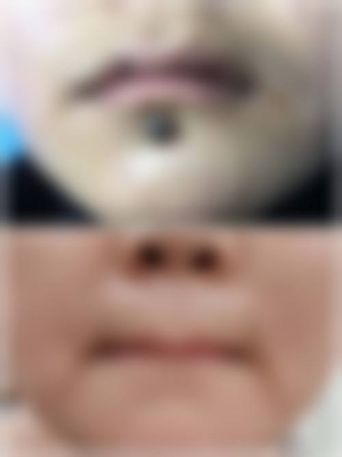 七、安徽柠檬轻医疗美容门诊部预约方式