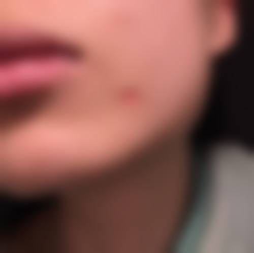 三、安徽柠檬轻医疗美容门诊部诊疗项目有哪些？