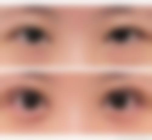 八、唐山素妍整形医院真实的患者评价