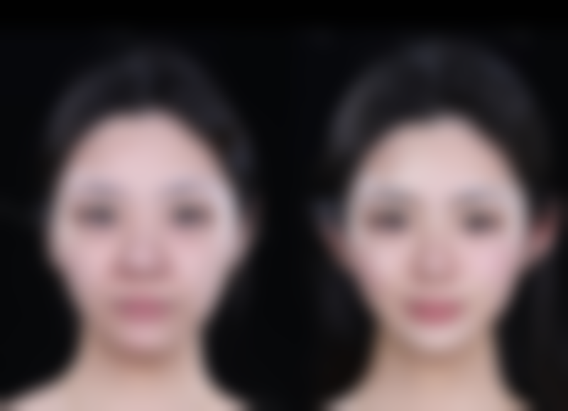 四、医疗手段的提示