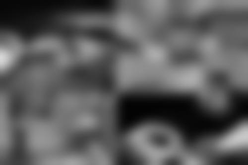 四、手臂吸脂后的注意事项