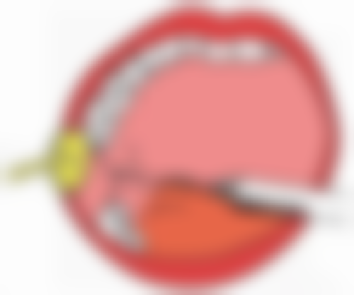 三、全切双眼皮术后化妆注意事项