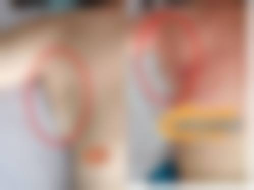 二、惠州馨依人医疗美容诊所怎么样？