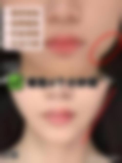 四、南通星范医疗美容门诊特色项目