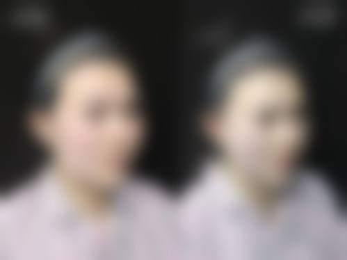 八、南通星范医疗美容门诊真实的患者评价